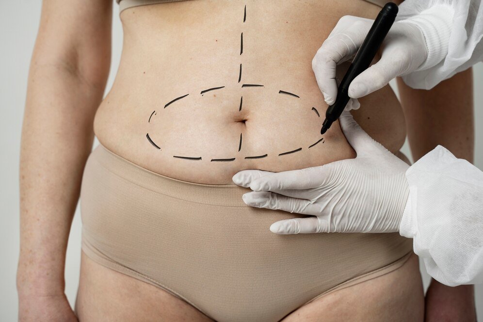 Plastic Surgery - Vital Global Care