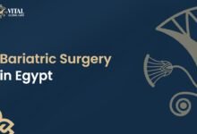 Bariatric Surgery in Egypt - Vital Global Care