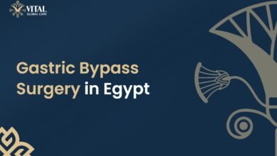Gastric Bypass Surgery in Egypt - Vital Global Care
