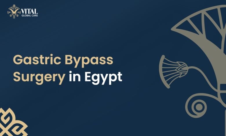 Gastric Bypass Surgery in Egypt - Vital Global Care