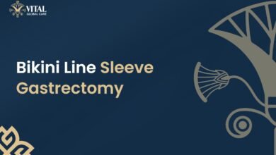 Bikini Line Sleeve Gastrectomy