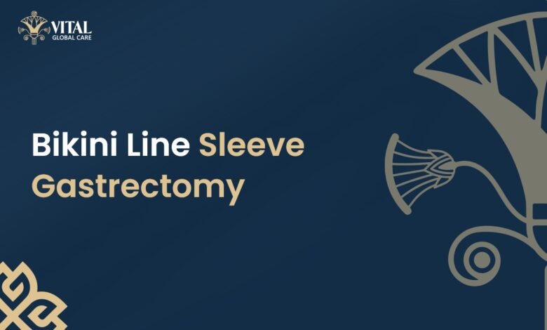 Bikini Line Sleeve Gastrectomy