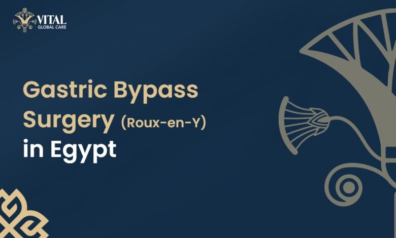 Gastric Bypass Surgery in Egypt