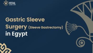 Gastric Sleeve Surgery in Egypt