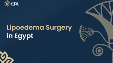 Lipoedema in Egypt