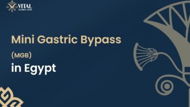 Mini Gastric Bypass in Egypt