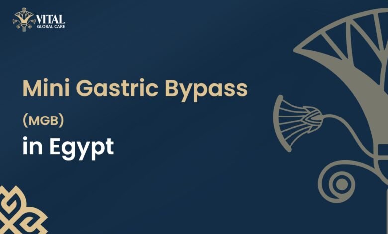 Mini Gastric Bypass in Egypt
