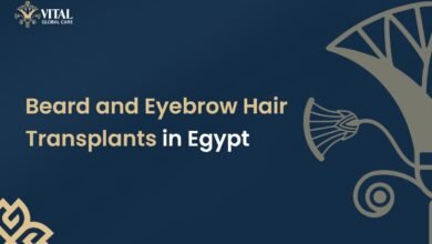 Beard and Eyebrow Hair Transplants