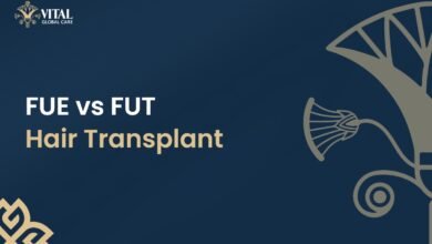 FUE vs FUT Hair Transplant
