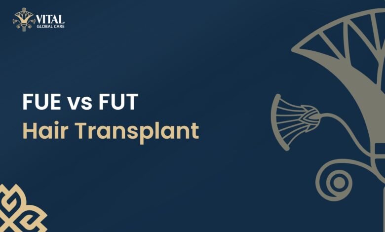 FUE vs FUT Hair Transplant