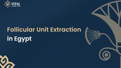 Follicular Unit Extraction (FUE) in Egypt