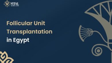 Follicular Unit Transplantation (FUT) in Egypt