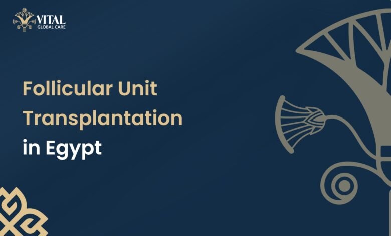 Follicular Unit Transplantation (FUT) in Egypt