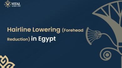 Hairline Lowering (Forehead Reduction) in Egypt