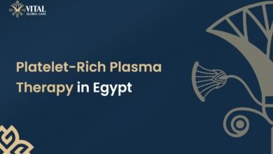 Platelet-Rich Plasma Therapy in Egypt
