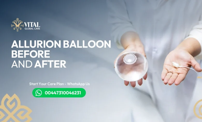 Allurion Balloon Before and After Cost vs. Weight Loss Value
