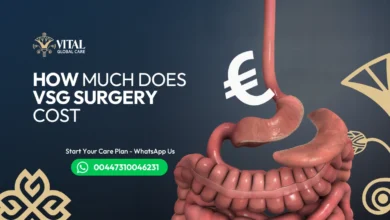 How much does VSG surgery cost Full Breakdown
