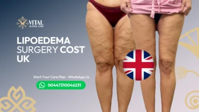 Lipoedema Surgery Cost UK​ - Full Price Breakdown