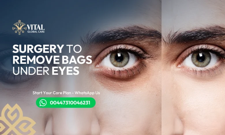 Surgery to Remove Bags Under Eyes: Permanent Solution Guide