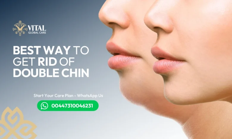 Best Way to Get Rid of Double Chin - Doctor-Approved Methods