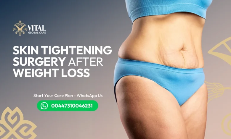 Skin Tightening Surgery After Weight Loss - The Guide