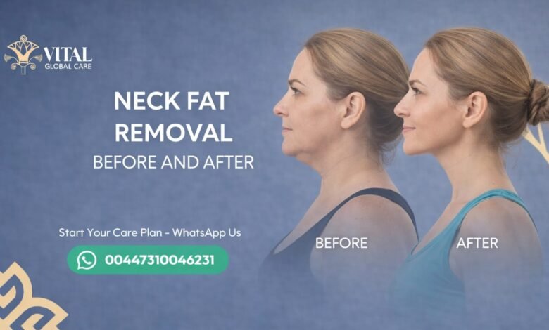 Visible Changes - Neck Fat Removal Before and After Guide