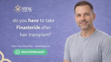 Do You Have to Take Finasteride After Hair Transplant