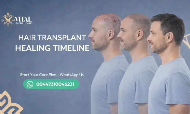 Full Hair Transplant Healing Timeline - Month-by-Month
