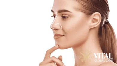 Find the Best Non Surgical Rhinoplasty Near Me Safely