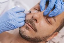 The Secret of Small Dimples on Face - Beauty & Science